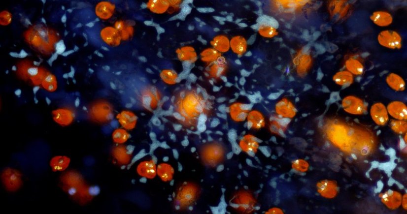 BRESSER MikroCamII 9MP 4K 1" senzor